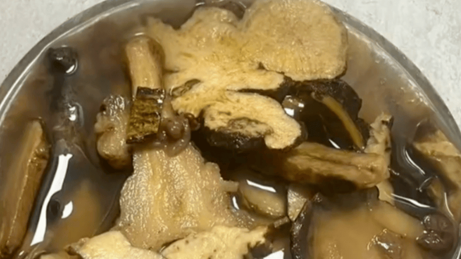 35歲男子不幸喪命！跟風“自制熱潮”，警惕良藥變毒藥，美食變“黴”食