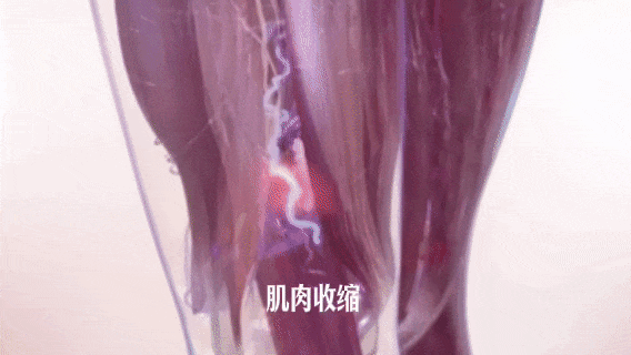 全民健身日：這份靜脈曲張專屬的健身攻略請收藏